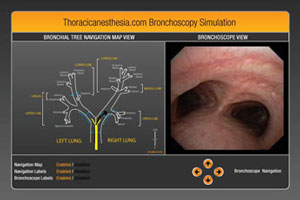 bronchoscopy simulator bronchoscopy simulator